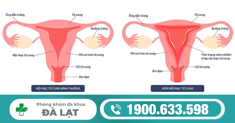 Hình ảnh minh họa